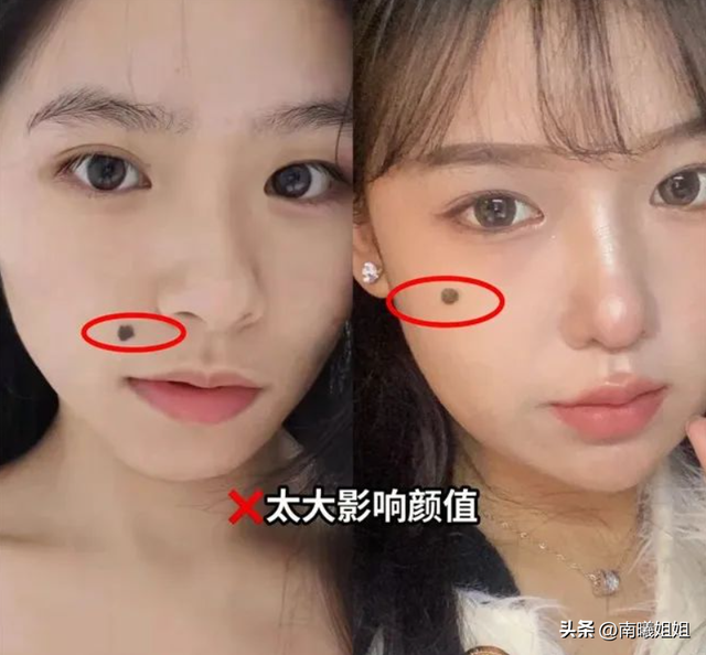 脸上这4处有“痣”的女人，属于天生的美人，气质不仅高级又迷人