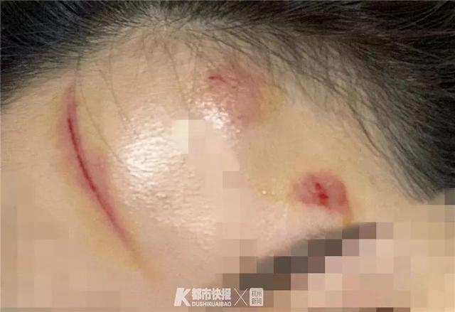 23岁美女模特密室玩游戏被“鬼”吓得逃窜绊倒，脸部划伤缝针！损失大了