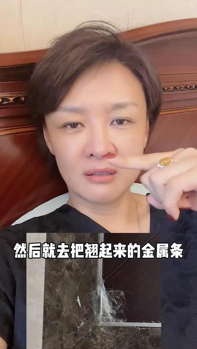 前央视主持突发意外！脚被钢条穿透鲜血直流，素颜躺床上罕露白发