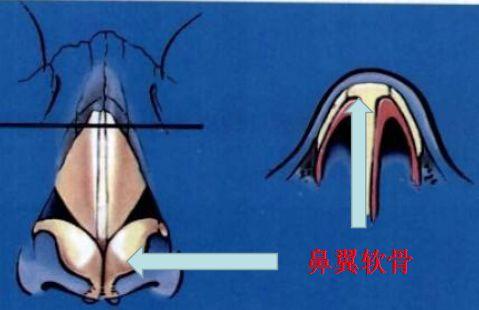 Angelababy直播卸妆疑翻车，鼻子掰歪急忙捂住，热议两边倒