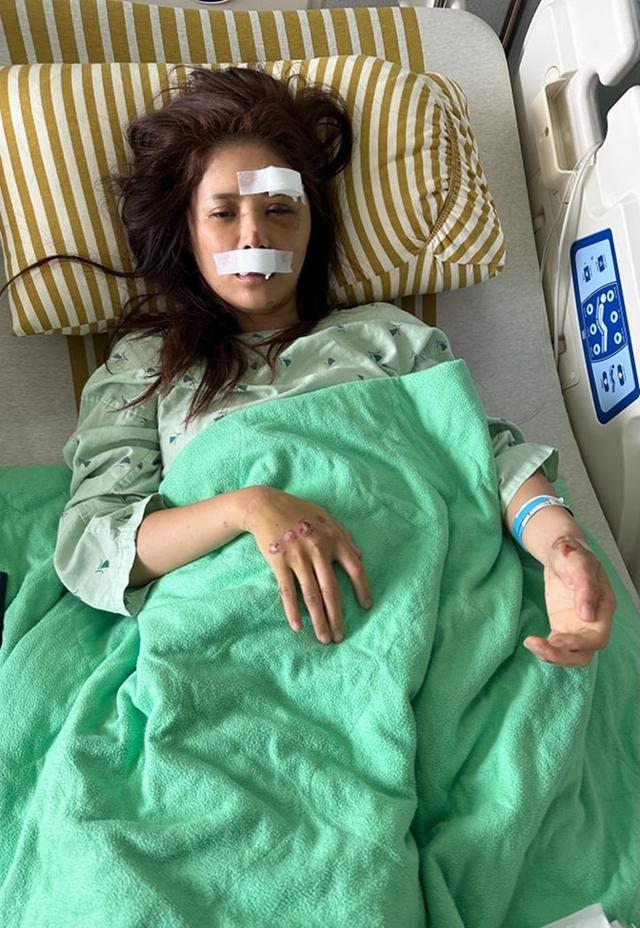 35岁美女主播车祸毁容！头撞地昏迷脑出血，紧急送医伤势照曝光