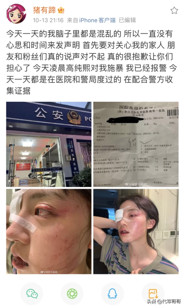 又一位美女网红遭男友家暴，受伤照片惨不忍睹，男方将去自首认错