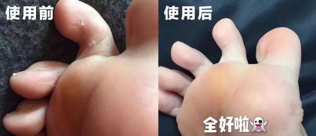 为什么日本妹子的脚暴走一天都不臭？