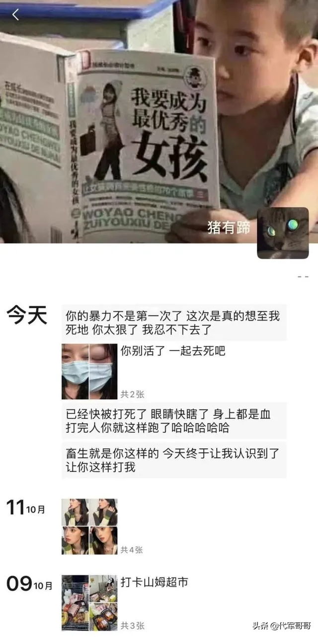 又一位美女网红遭男友家暴，受伤照片惨不忍睹，男方将去自首认错