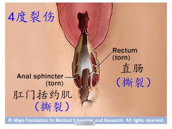 实拍揭秘：女人生孩子的过程，是男人无法想象的痛，当妈真不容易