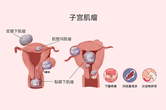 “裤子脱了腿张开”，医院让人脸红的妇科检查，没有性生活要做吗