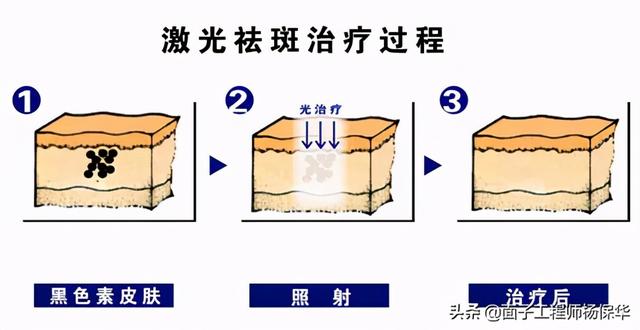 倪妮的欧美雀斑太帅了，普通人应该如何驾驭？