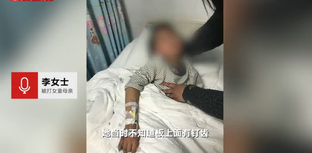 重庆一7岁女童因未完成作业被班主任打伤臀部，涉事班主任已被停课，当地警方介入