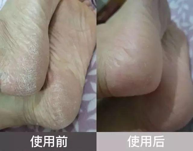 女神秦岚美是美，可这双脚真是太让人出戏，身高165却有40码大脚