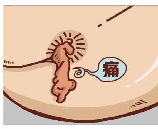 肛乳头瘤，可怕之处在哪里？