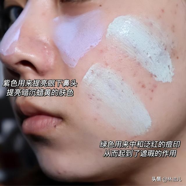 女明星长痘也喜欢晒，乔欣说自己是乞丐肌，刘涛痘痘遮都遮不住