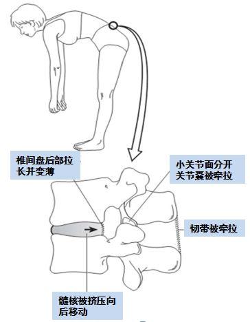 五禽健腰操丨美女医生教学，每天5-10分钟和腰痛说再见