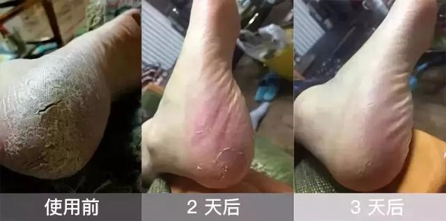 女神秦岚美是美，可这双脚真是太让人出戏，身高165却有40码大脚