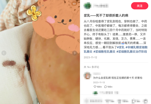 浆乳，一种死不了却让女性受尽折磨的痛……