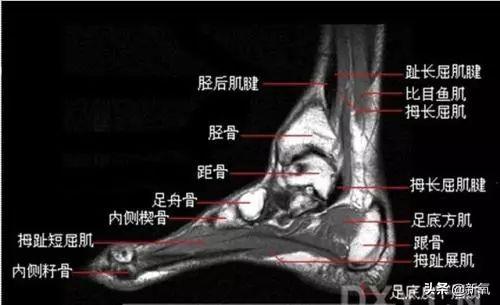 孟美岐跳舞把脚崴成90度，还曾因脚伤差点没出道，心疼