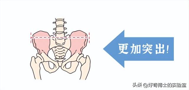 为什么很多女生屁股两侧，会有个小凸起？