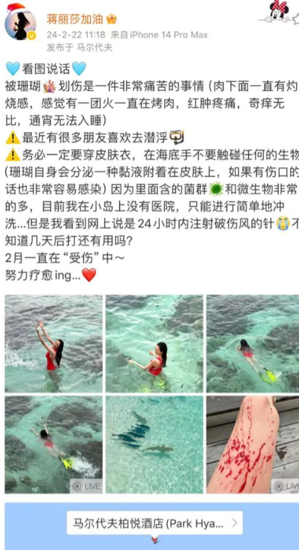 突发！陈浩民太太被珊瑚划伤！晒受伤照血流不止，美腿留大片伤疤