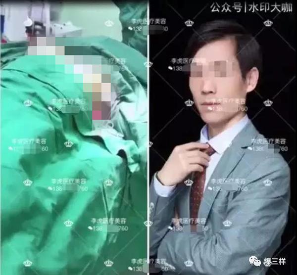 不可描述！这位医生把无打码的丰胸视频分享了在朋友圈……