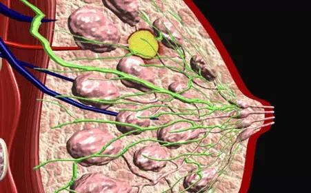 26岁美女乳房长了十个肿瘤，医生说爱生闷气年轻女性高发