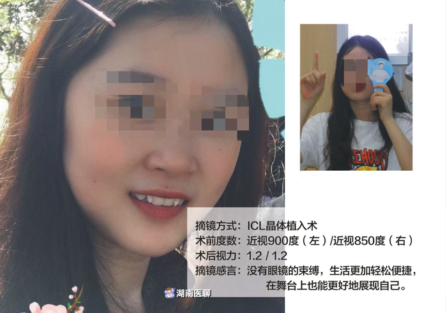 妙龄女子戴镜十年，近视高达900度！摘镜后，颜值蹭蹭蹭