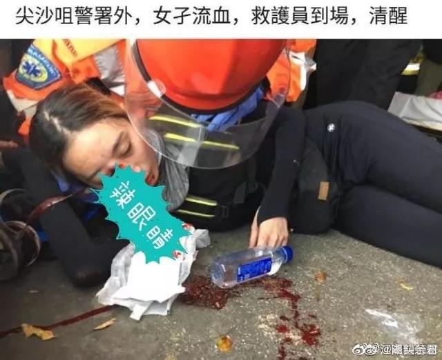 “女示威者被打爆眼”，香港警方：无证据显示是警方所为