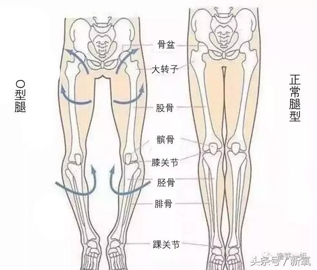 上天嫉妒娜扎的脸，才赐她这么一双O型腿