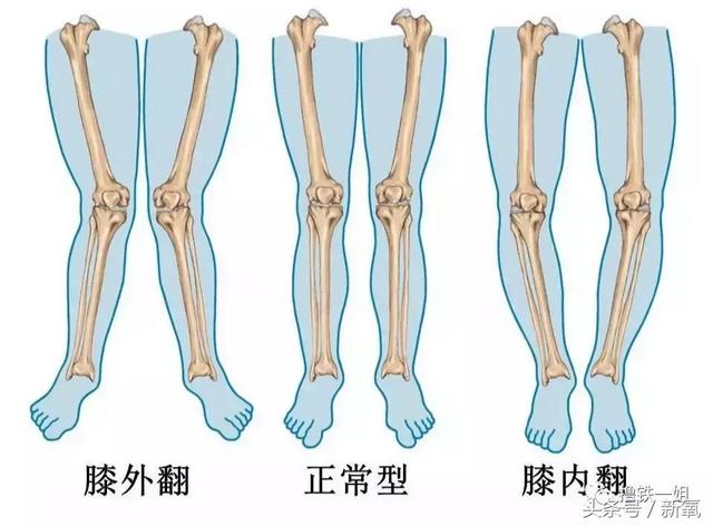 上天嫉妒娜扎的脸，才赐她这么一双O型腿