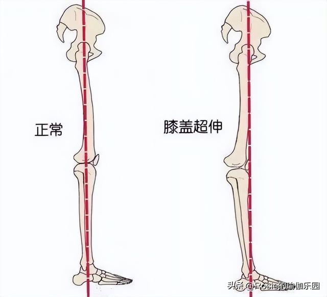 47岁舒淇腿长逆天翘臀妩媚，臀侧凹陷大腿凸如何逆袭？4步轻松练