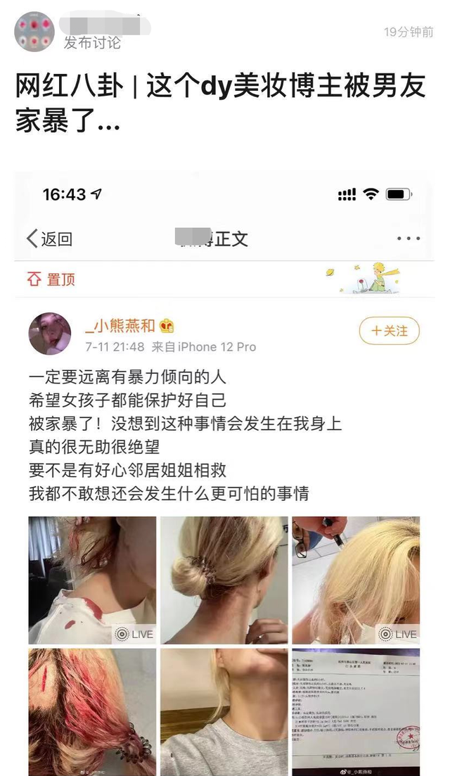 美女网红惨遭男友家暴，头部裂伤严重都是血，被邻居救后绝望发文