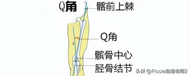 杨超越红毯秀长腿身材火辣，膝盖内侧鼓包腿不直？5步轻松练